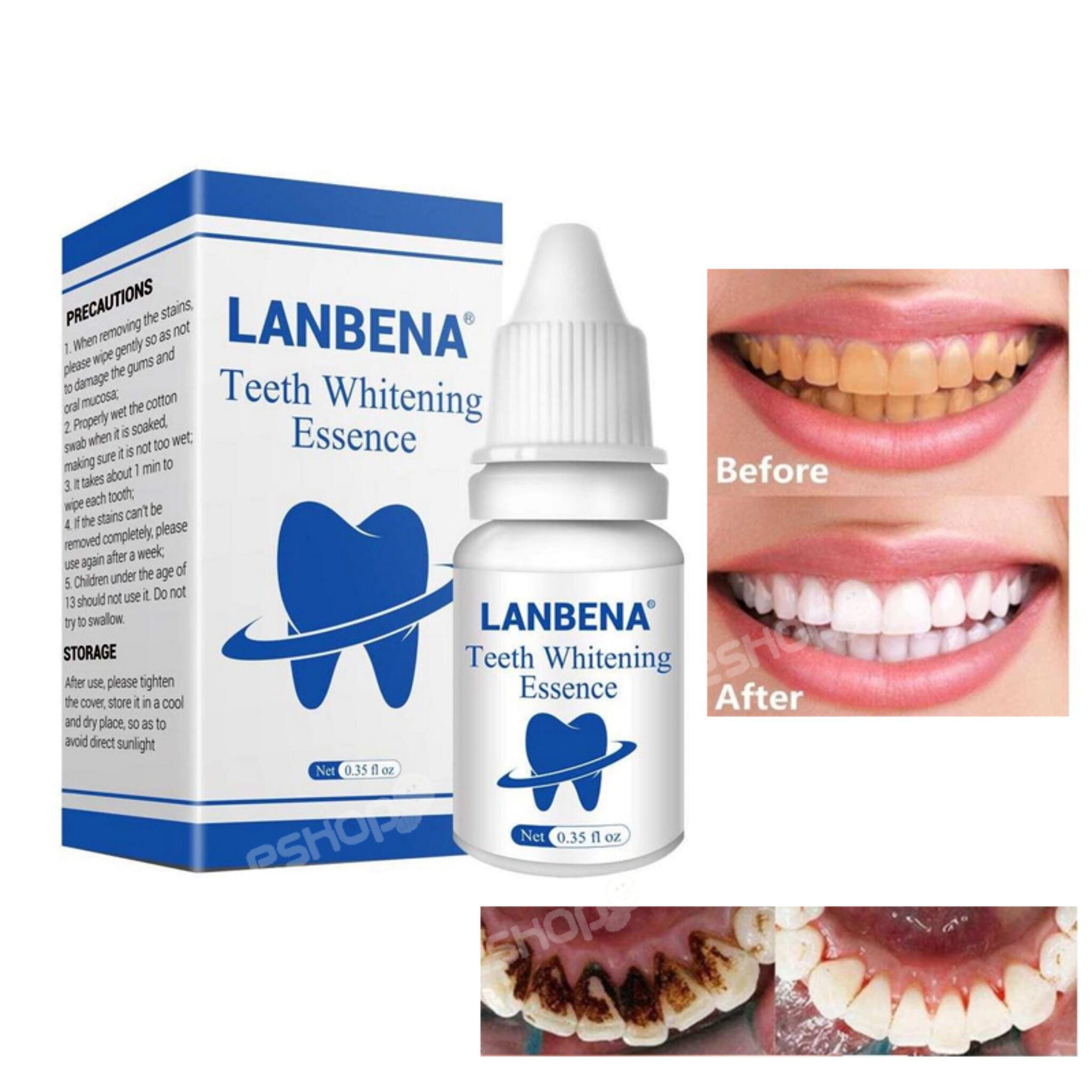 Lanbena teeth whitening oral hygiene and essence [100% ORIGINAL]