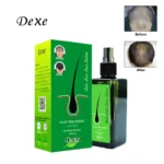 Hair Treatment DEXE Anti-Hair Loss Lotion 120ml